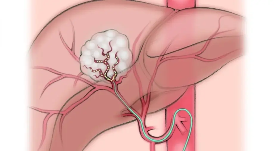 Other Miscellaneous Onco Services