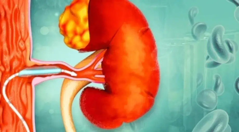 Other Miscellaneous Arterial Services