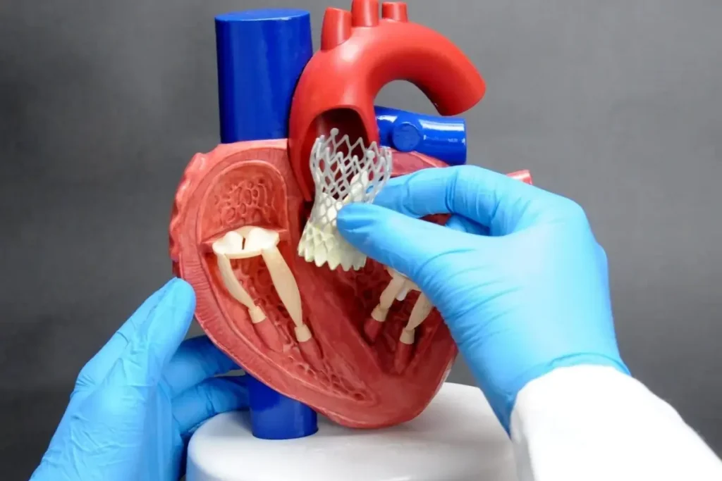 Aortic Dissection Repair
