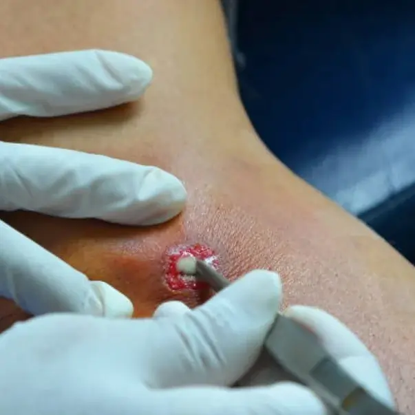 Persistent infections